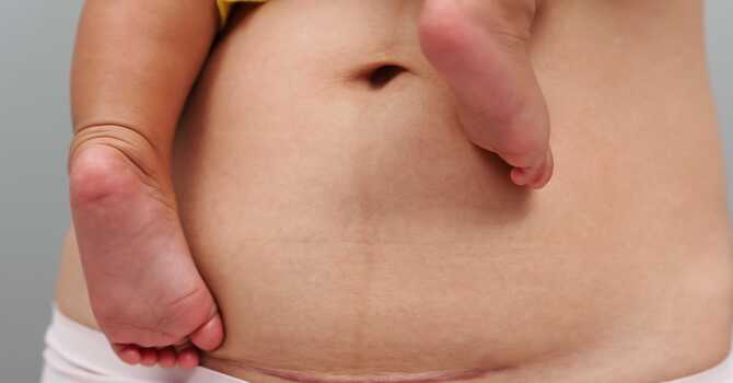 Post Partum Care