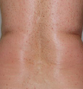 Unnamed Image