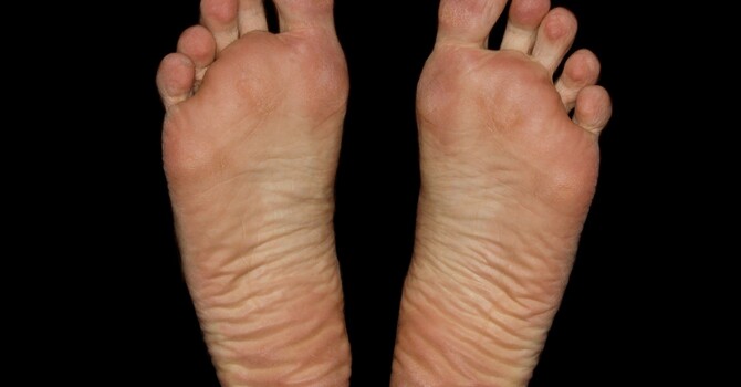 How To Test Your Foot Strength At Home image