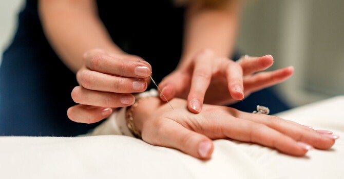 Acupuncture & Dry Needling