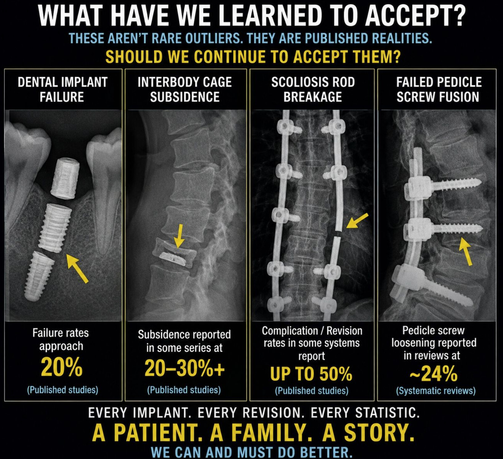 spine surgery failure