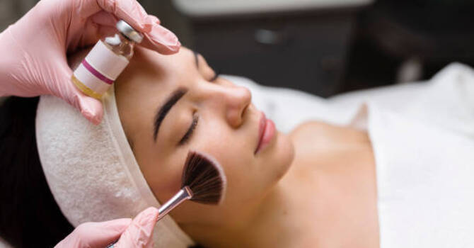 Chemical Peels