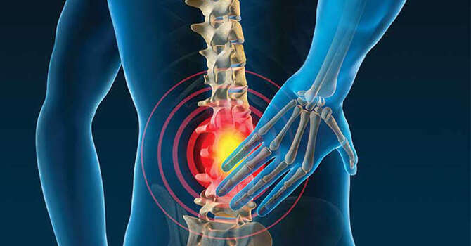 Chronic Low Back Pain Case Study
