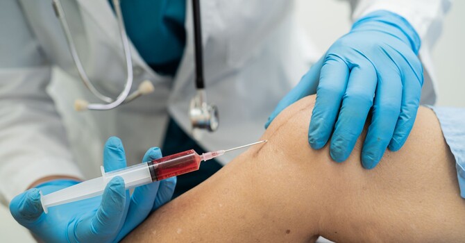 How Many High Density PRP Sessions Do You Actually Need? image