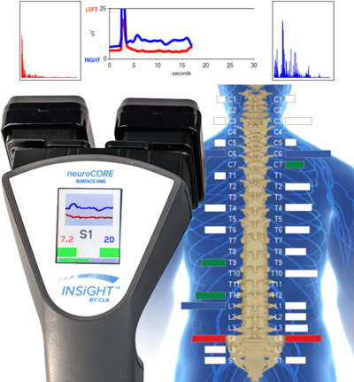 Technology used to evaluate nervous system stress and function