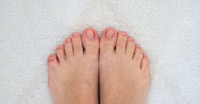 Ingrown Toe Nails