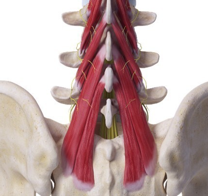 Example of Multifidus Muscles