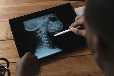 Herniated disc treatment in Kissimmee FL – gentle spinal adjustments, no surgery