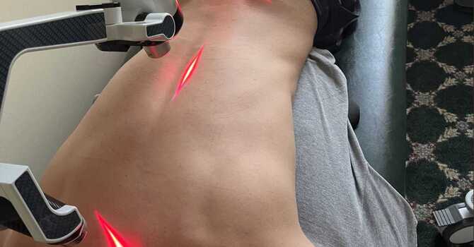 Erchonia FX 405 Cold Laser Light Therapy