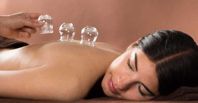 Acupuncture