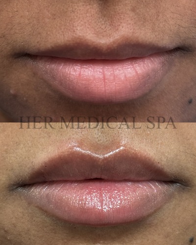 Lips example 2
