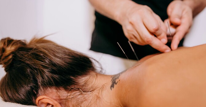 Initial Acupuncture Appointment (60 mins)
