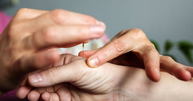Acupuncture & Chinese Medicine