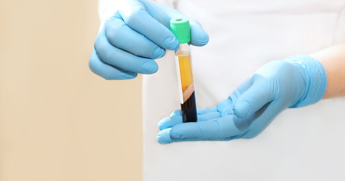 PRP Injection Rules