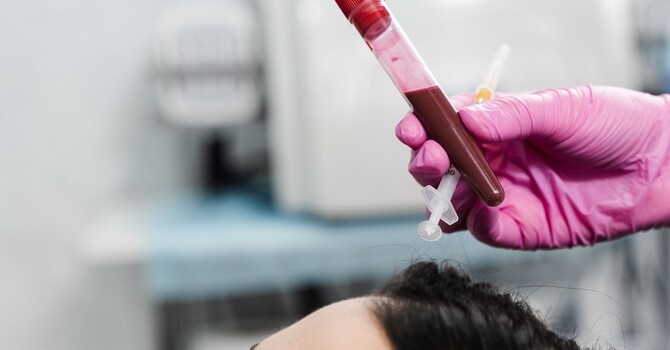 High Density PRP vs. Standard PRP image