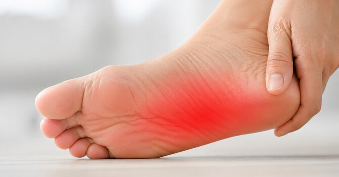 Plantar Fasciitis