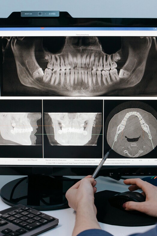 tmj disfunction and osteopathy