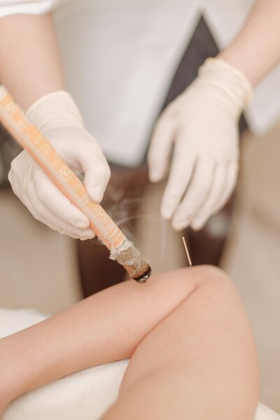 Moxibustion