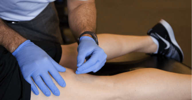 Dry Needling