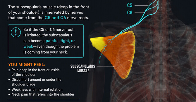 Why Your Neck May Be the Real Cause of Your Shoulder Pain