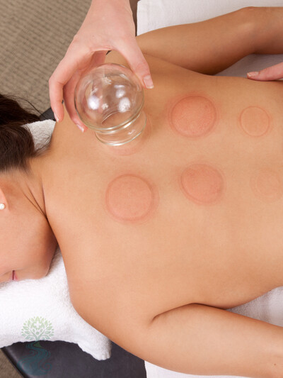 Acupuncture services at Blackriver Health & Therapy in Burnaby, BC.