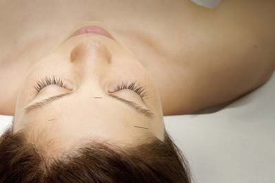 Face by Zhen™ | Cosmetic Acupuncture 
