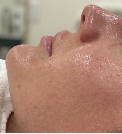 Link to: https://www.solskinnmedicalaesthetics.ca/services/skinn-health-method