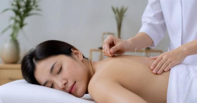 Acupuncture