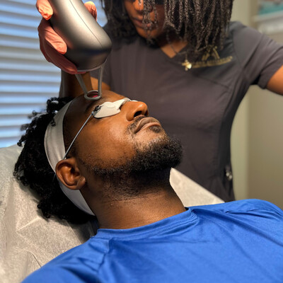Laser Facials