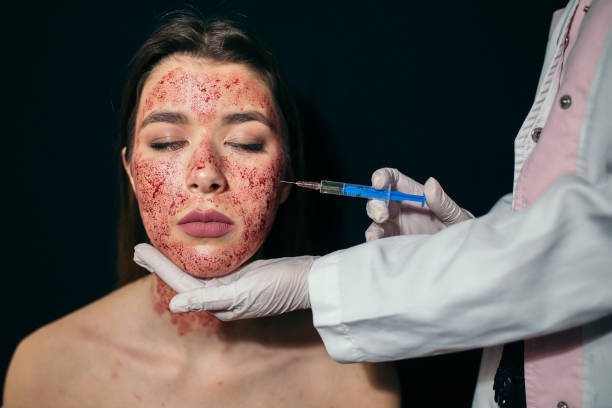 How Much Does the Vampire Facial Cost in the US?