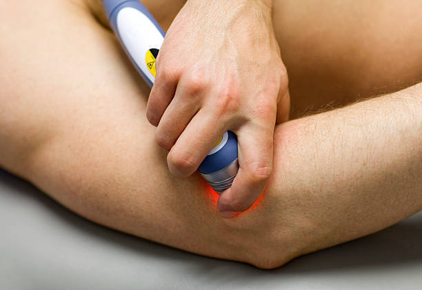 Laser Therapy - Theralase Technologies 
