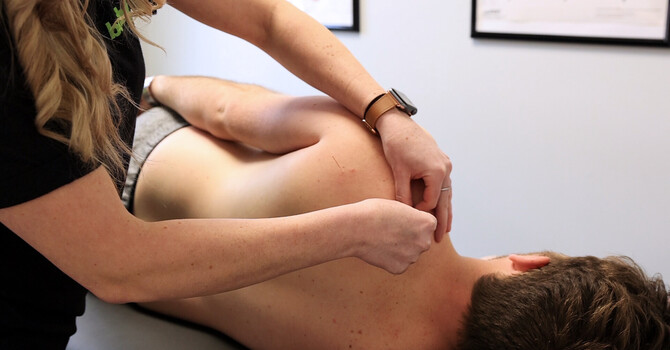 Acupuncture