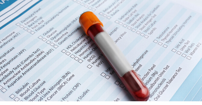 Labs & Diagnostics