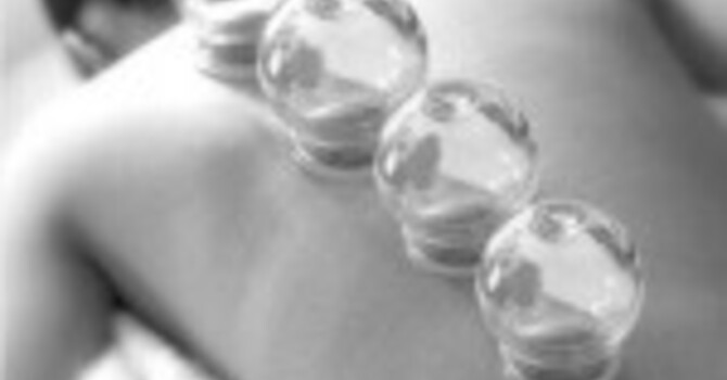 Cupping