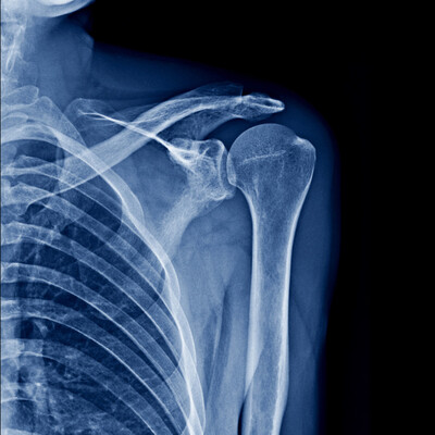  an on-site digital xray taken of a patients shoulder at green space health in tampa.