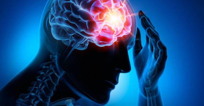 Concussion