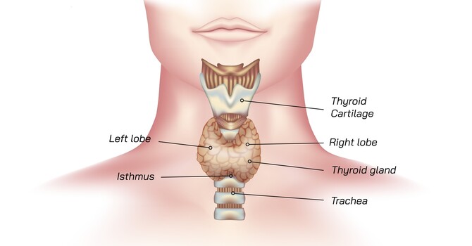 Hashimoto’s Disease image