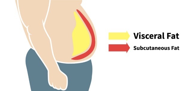 visceral fat