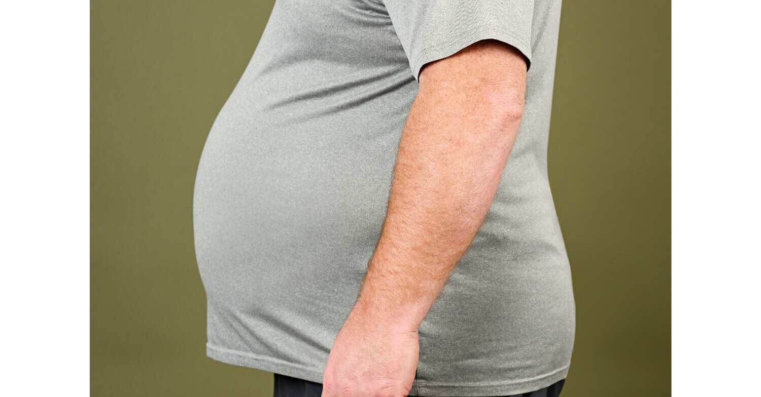 Man with protruding belly