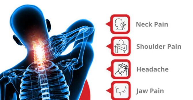 Tech Neck image