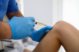 PRP Injections Encinitas 