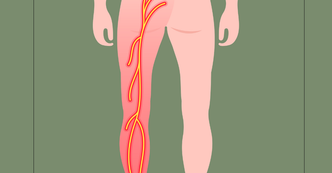 Cuidado Quiropráctico y Dolor Ciático: Lo Que Dice la Investigación