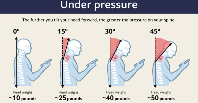 Tech Neck in Waukee: How Your Chiropractor Can Fix It image