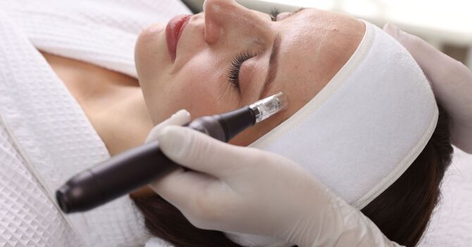 How Microneedling for Acne Scars Works (And Why It's So Effective) image