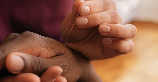 Acupuncture Injection Therapy: BIOTIN image