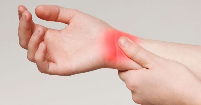 What Is Carpal Tunnel Syndrome? Causes, Symptoms, and How a Chiropractor Can Help image