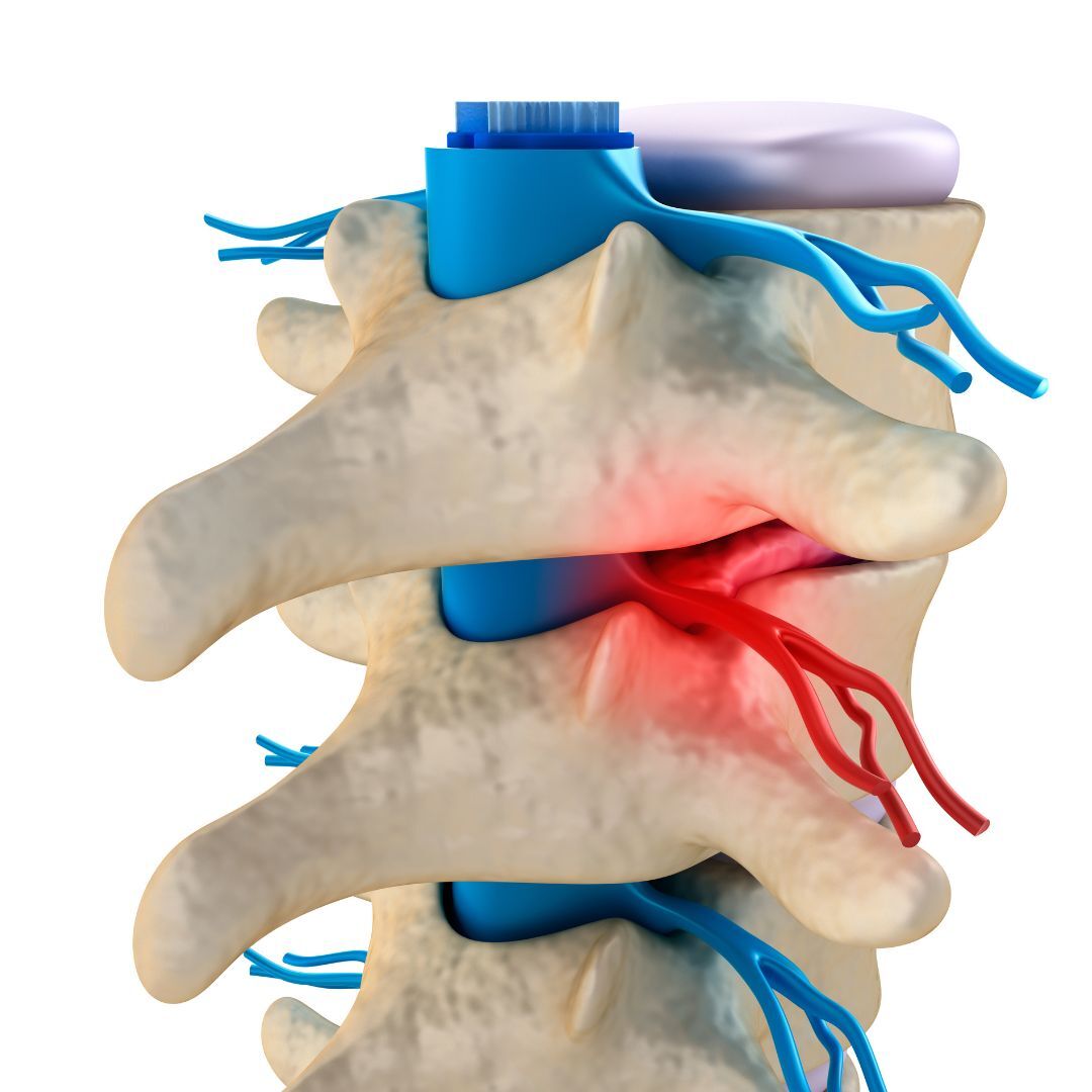 Chiropractic_for pain-relief-tampa (1)