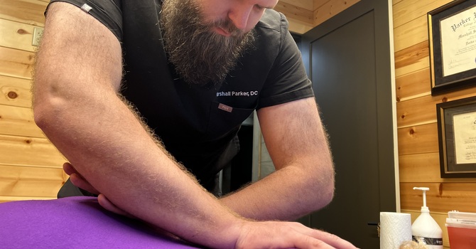 Cupping Therapy image