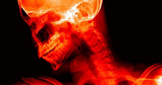 L'analyse radiologique chiropratique : ce qu'il faut savoir image