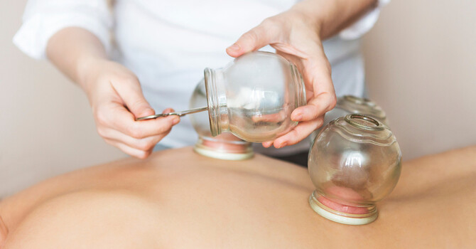 Fire Cupping